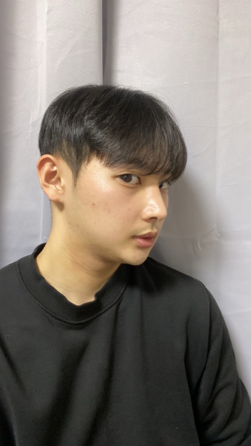 수술후기이미지