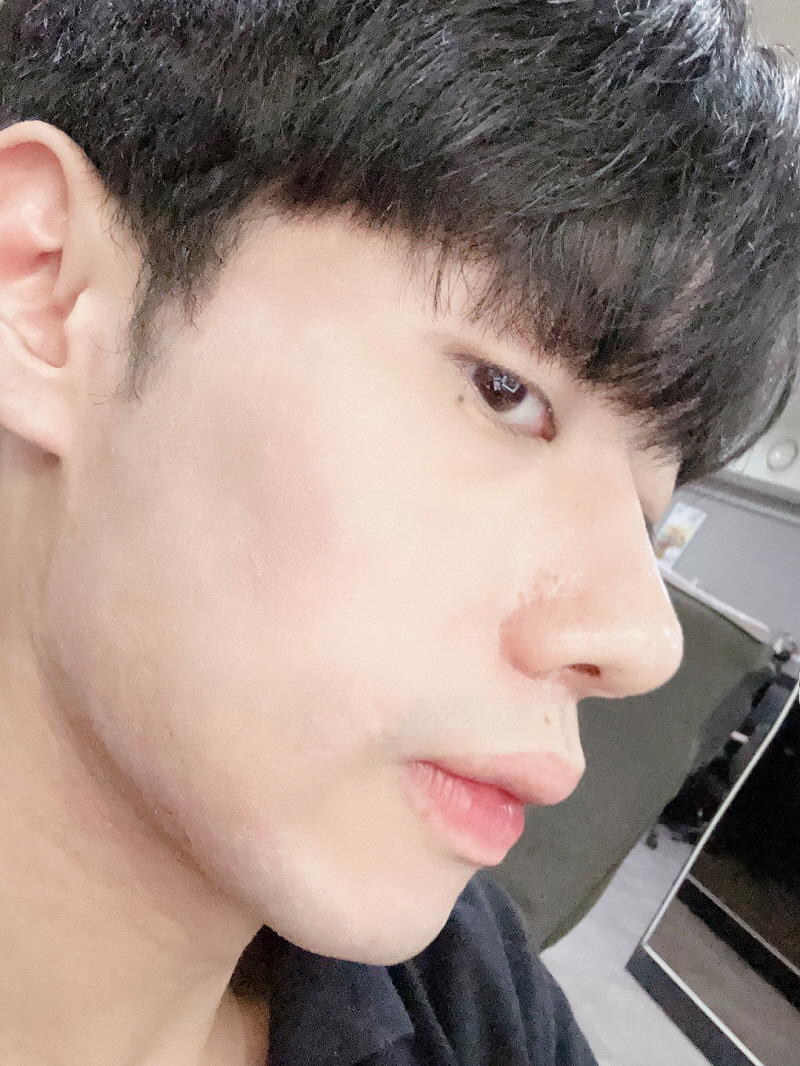 수술후기이미지