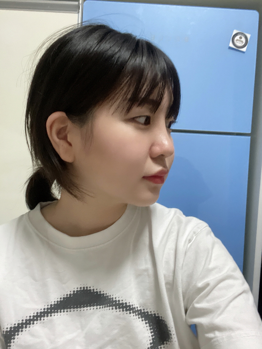 수술후기이미지