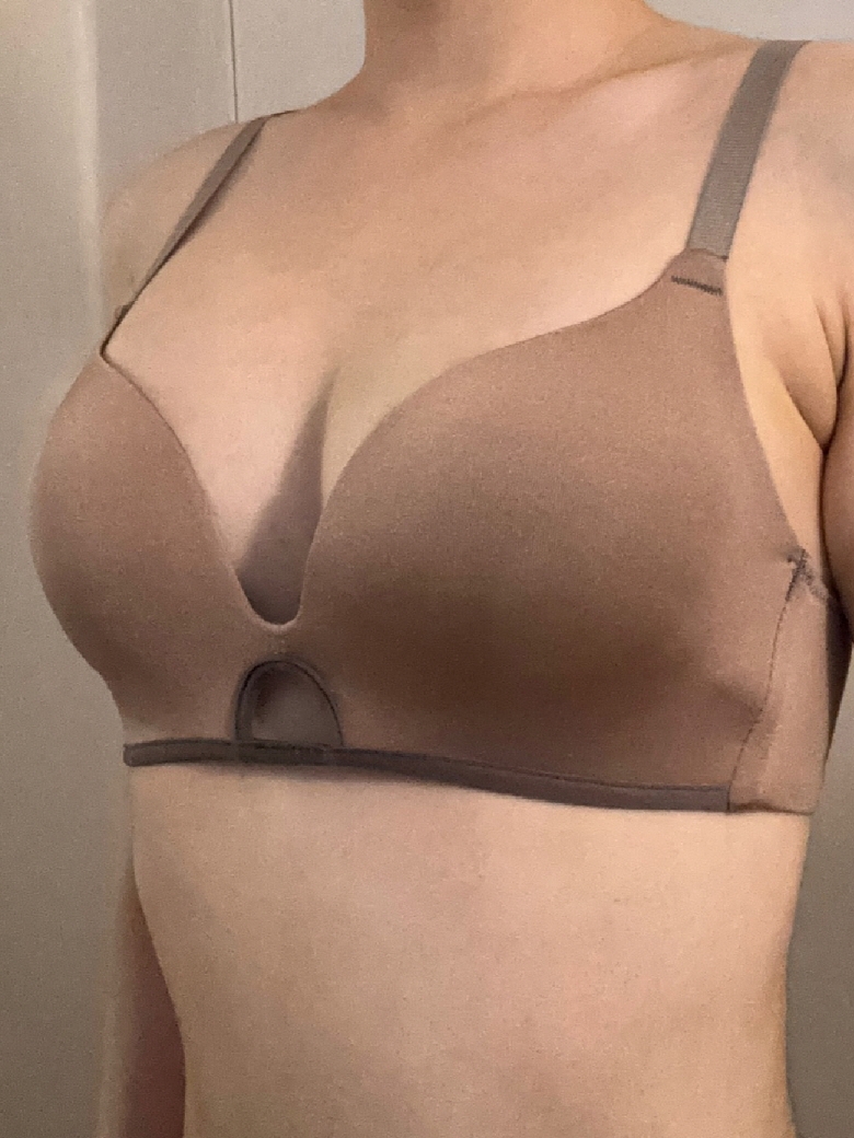 수술후기이미지