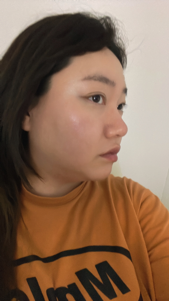 수술후기이미지