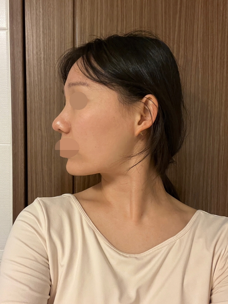 수술후기이미지