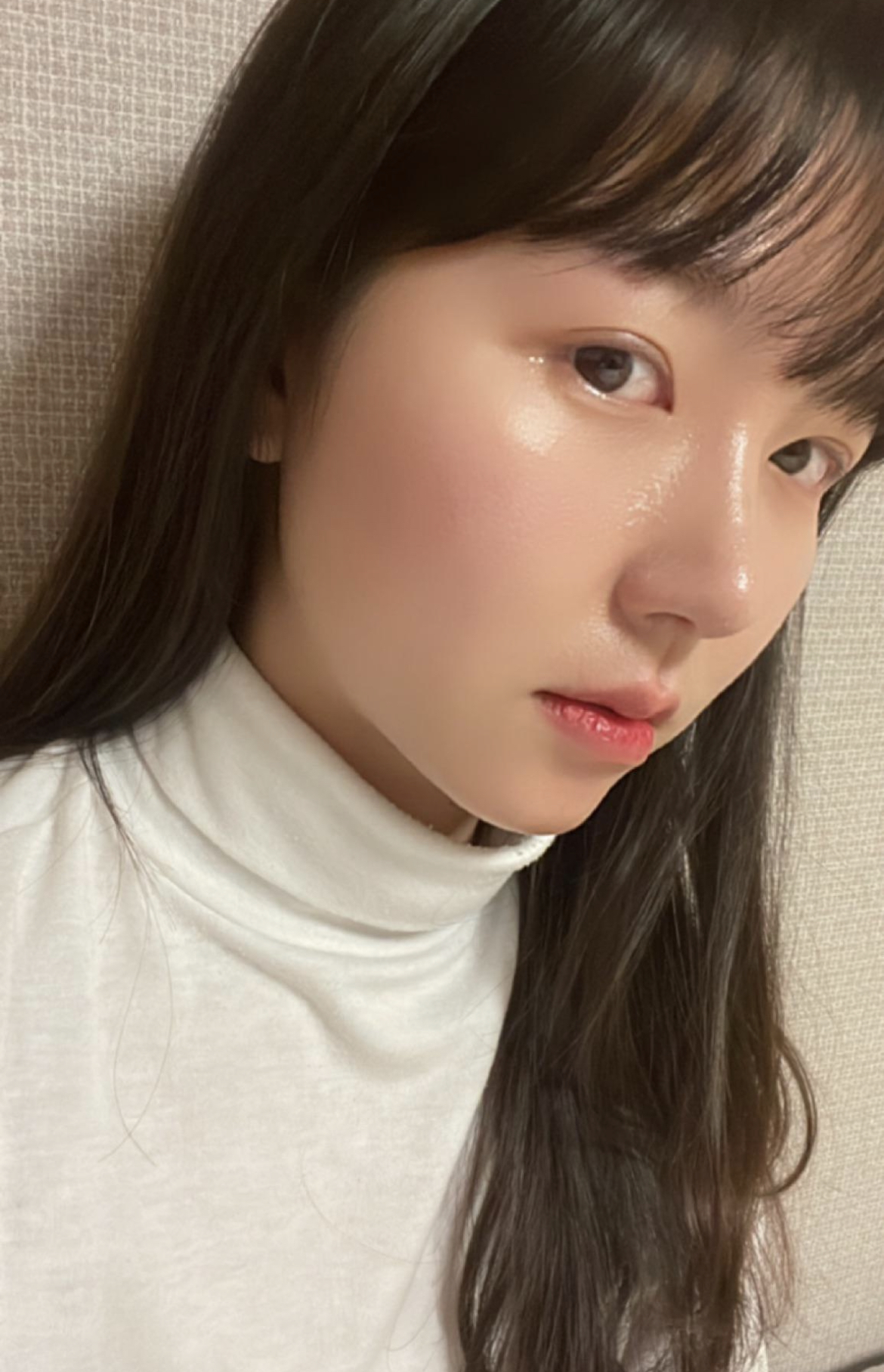 수술후기이미지