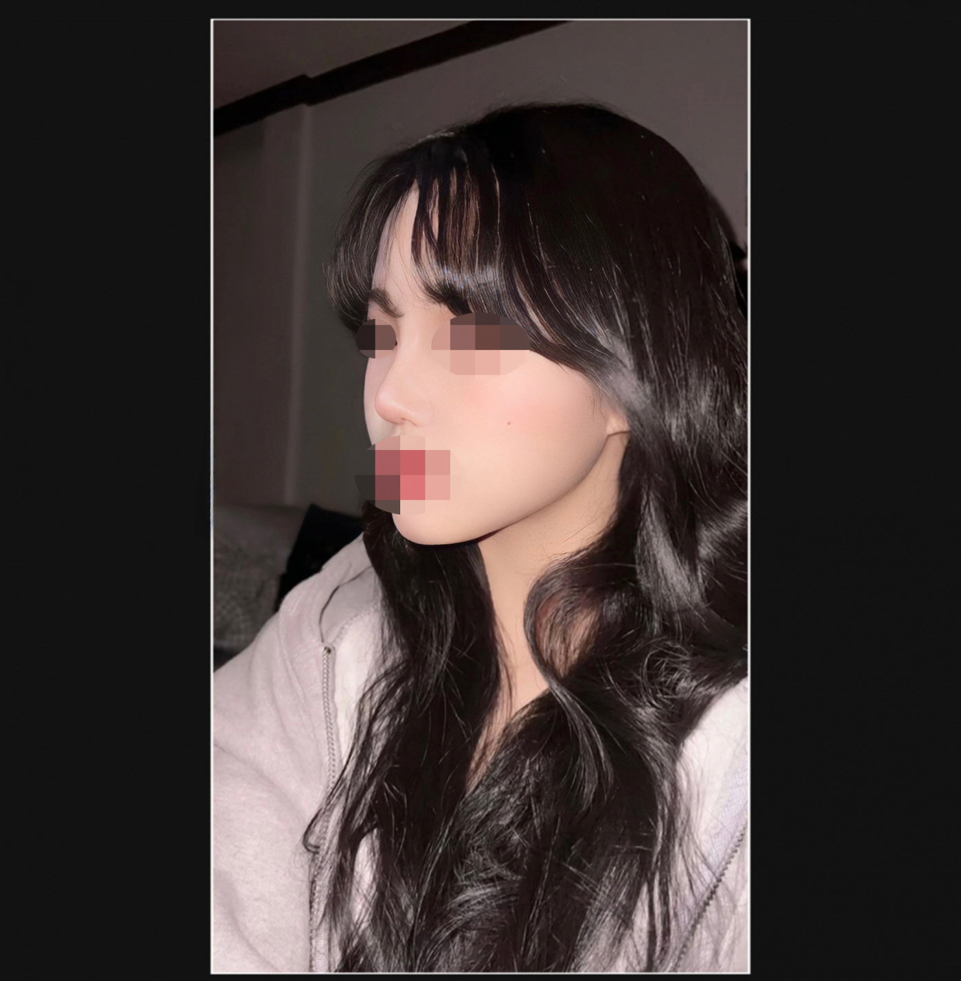 수술후기이미지