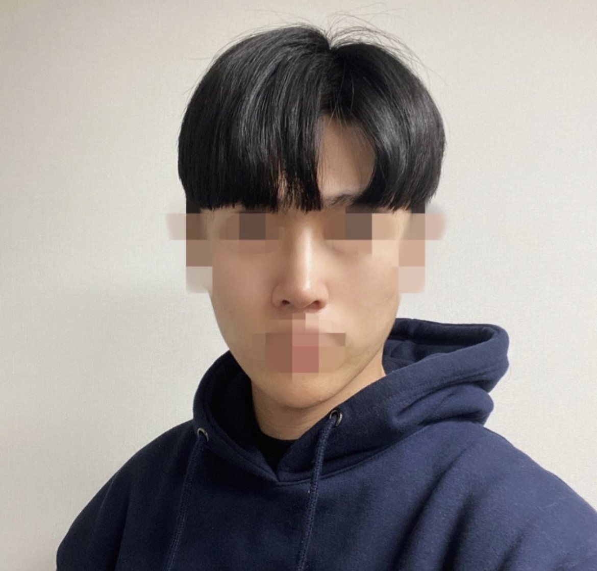 수술후기이미지