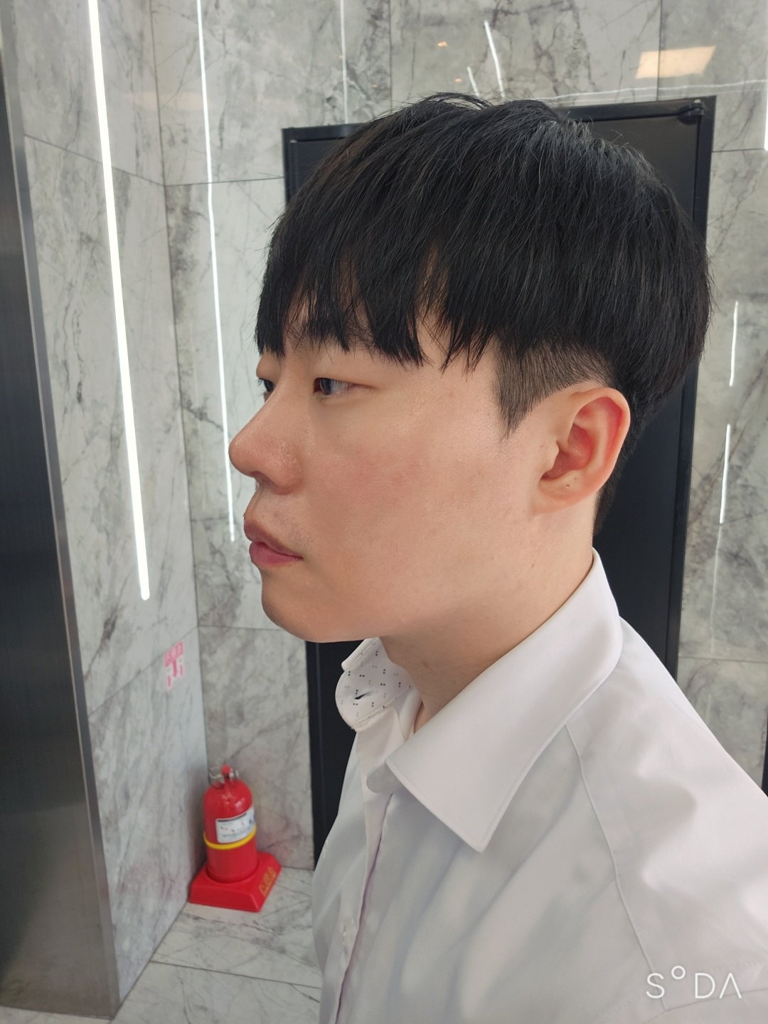 수술후기이미지