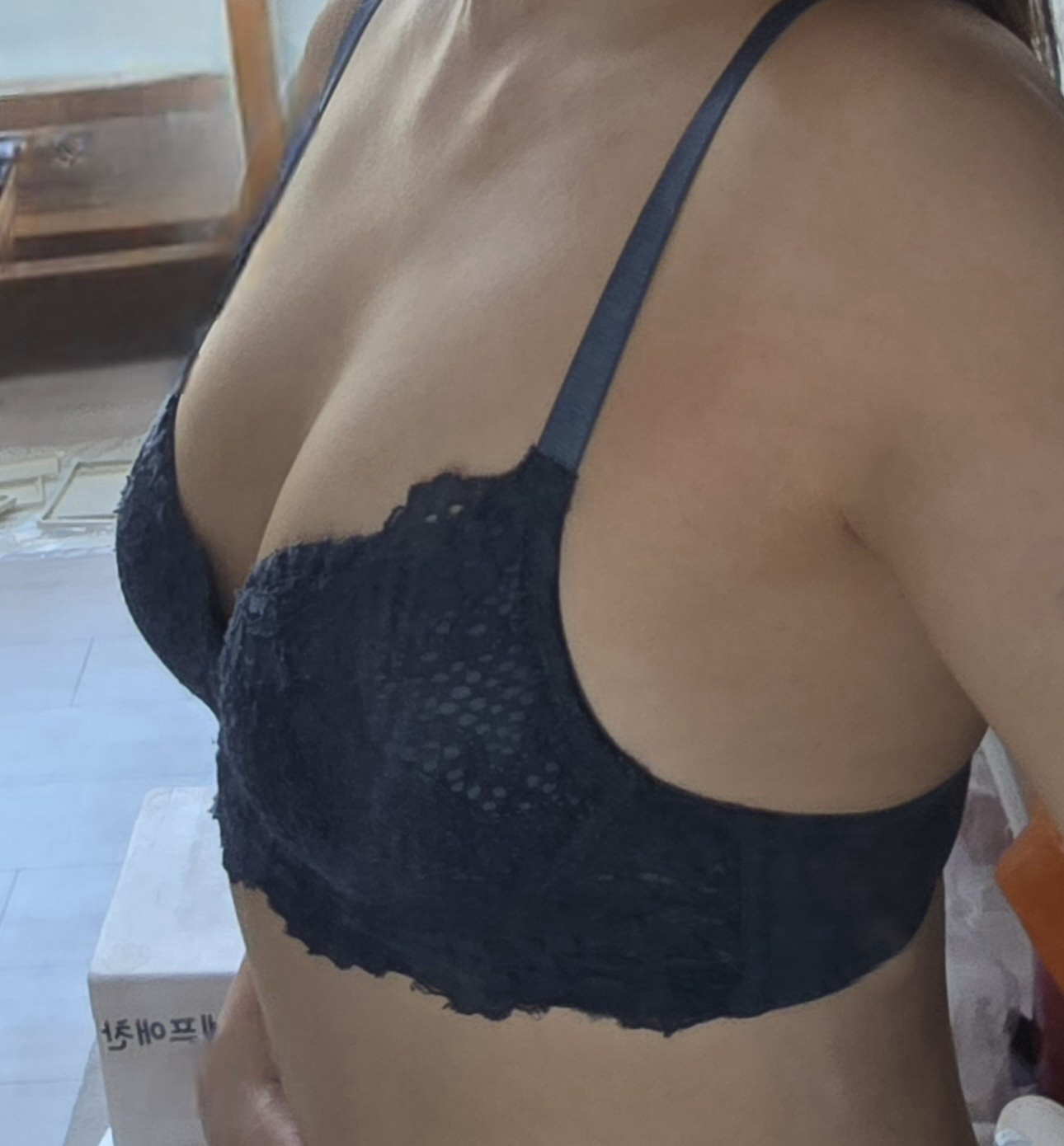 수술후기이미지