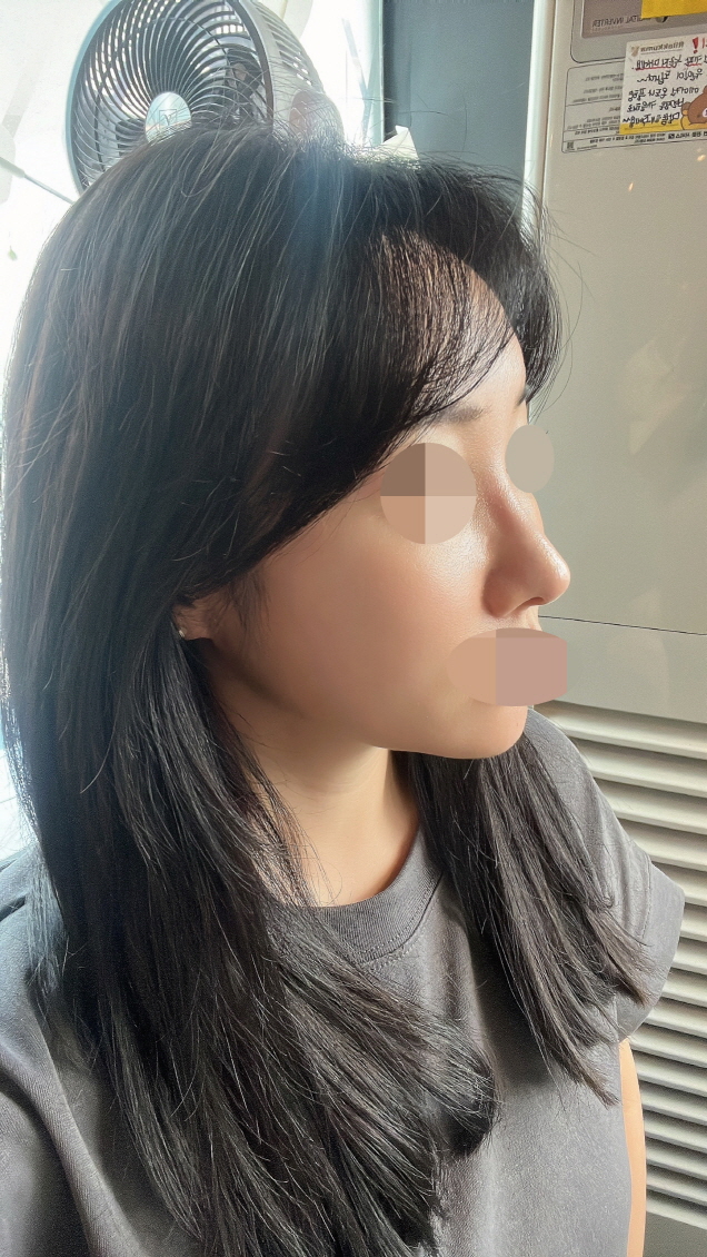 수술후기이미지