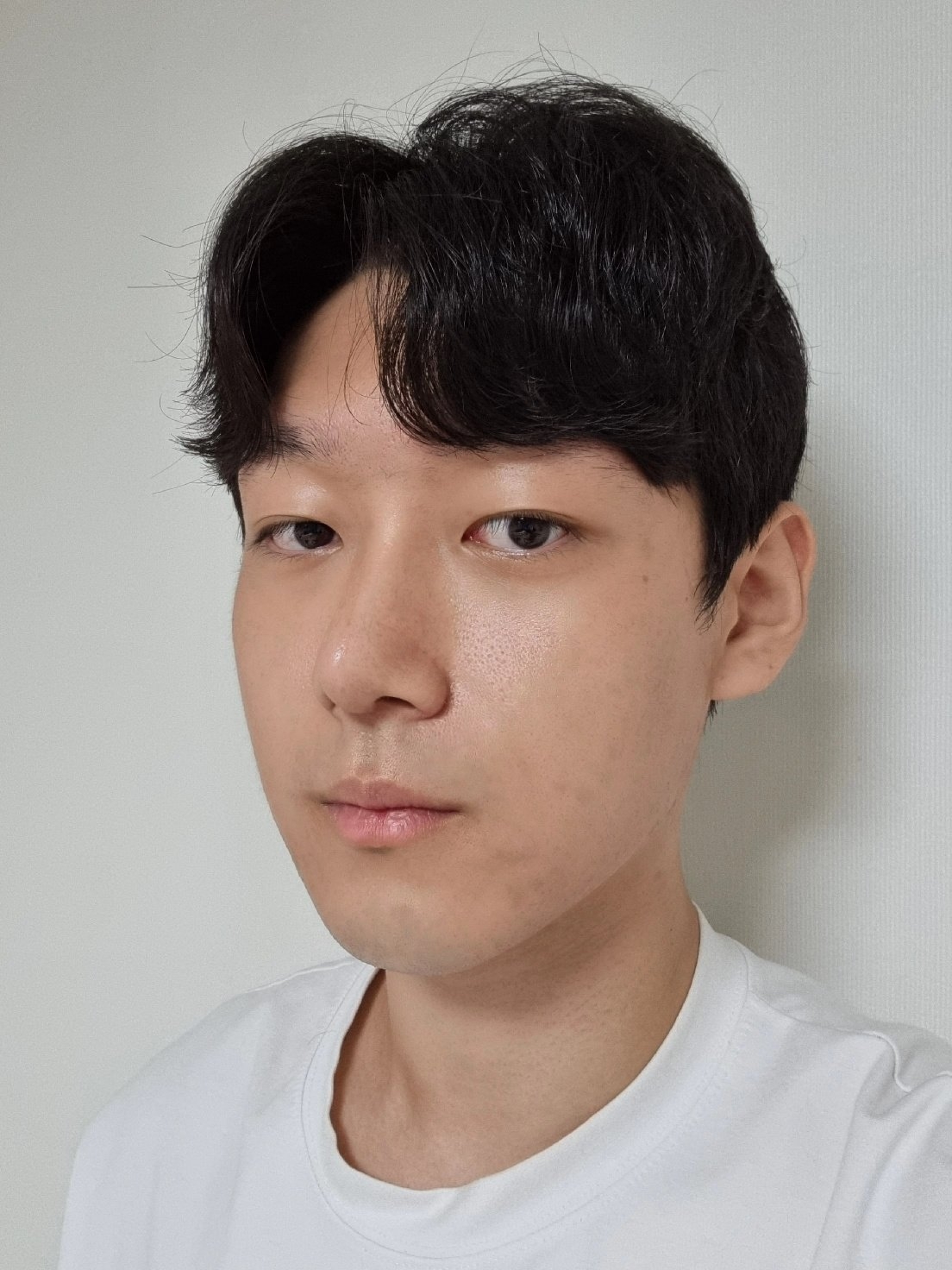 수술후기이미지