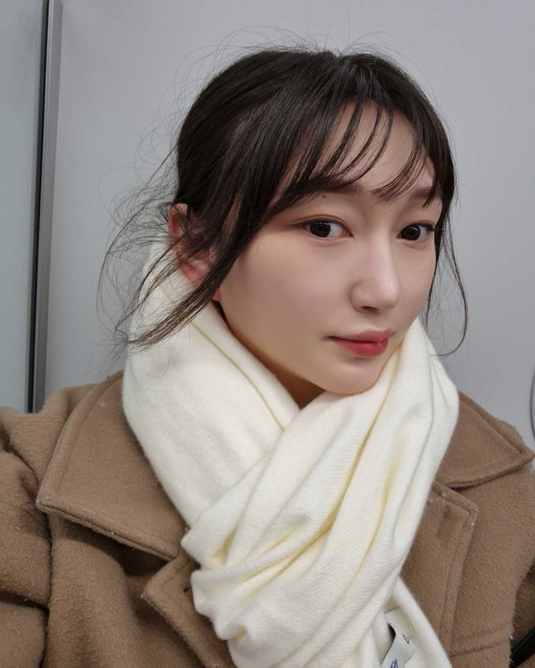 수술후기이미지