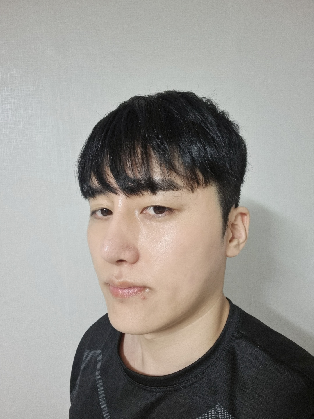 수술후기이미지