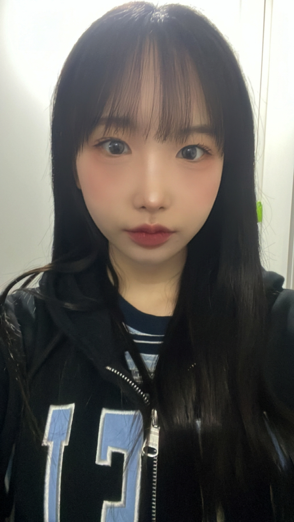 수술후기이미지