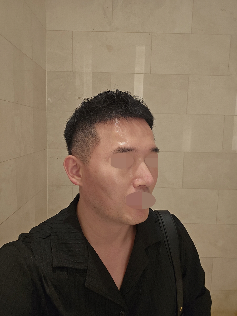 수술후기이미지