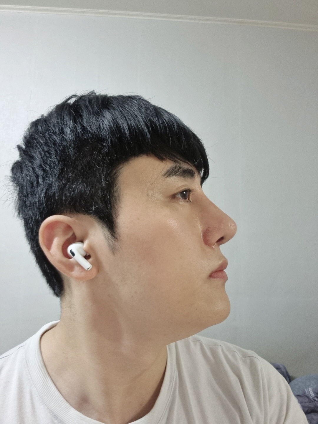 수술후기이미지