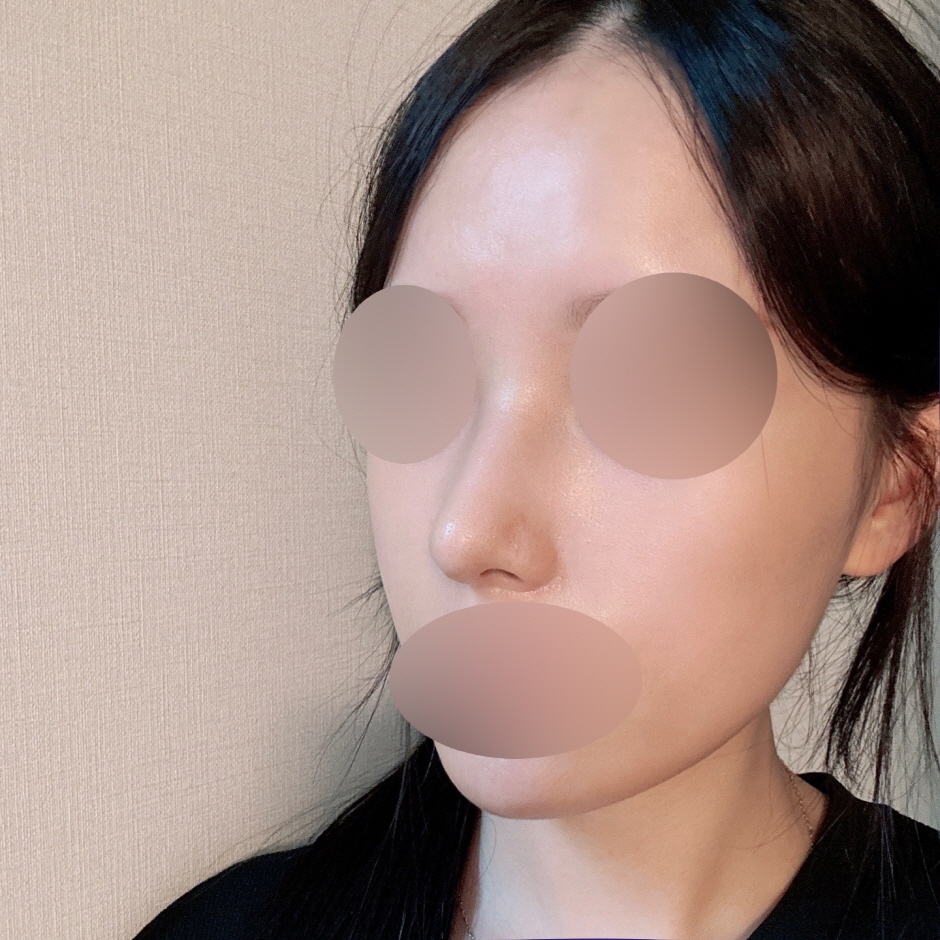 수술후기이미지