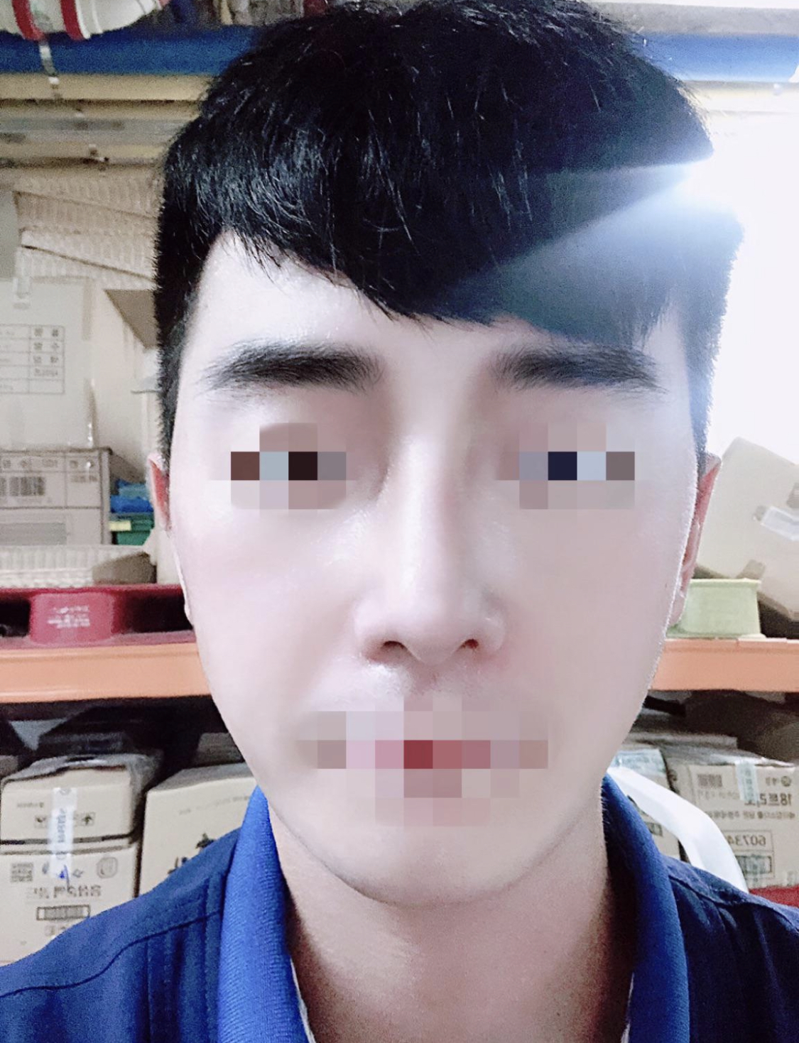 수술후기이미지