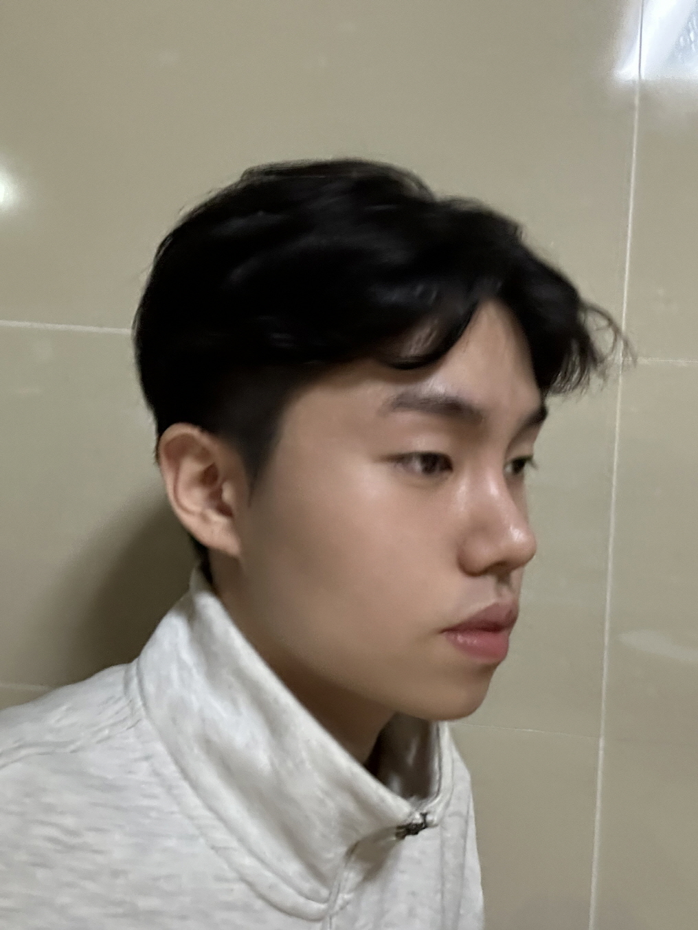 수술후기이미지