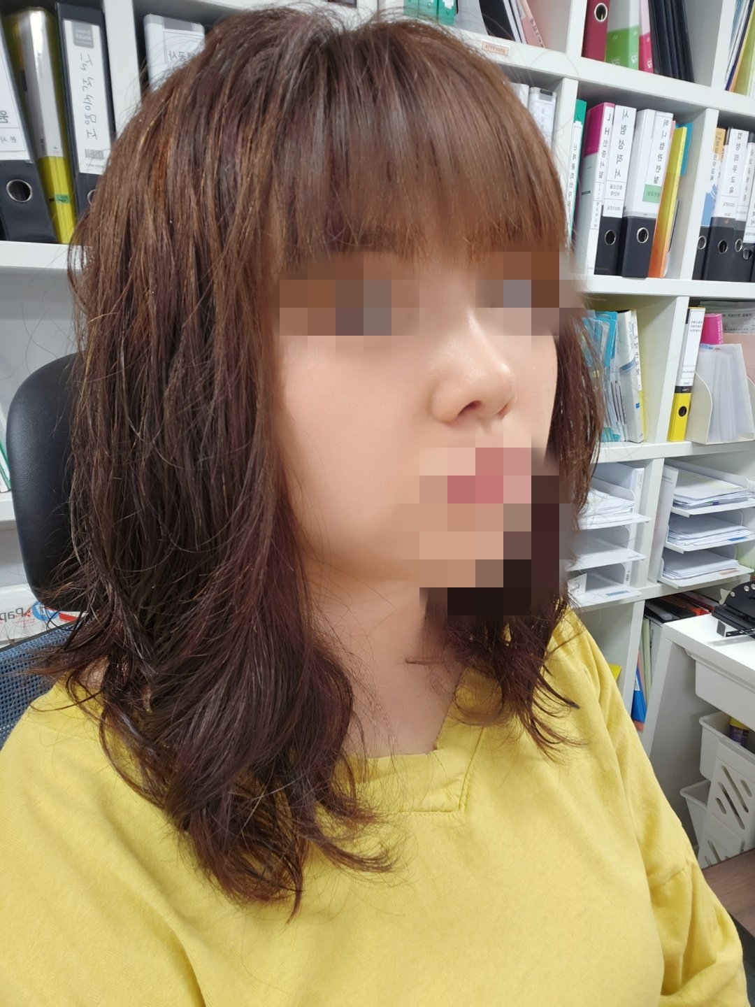 수술후기이미지