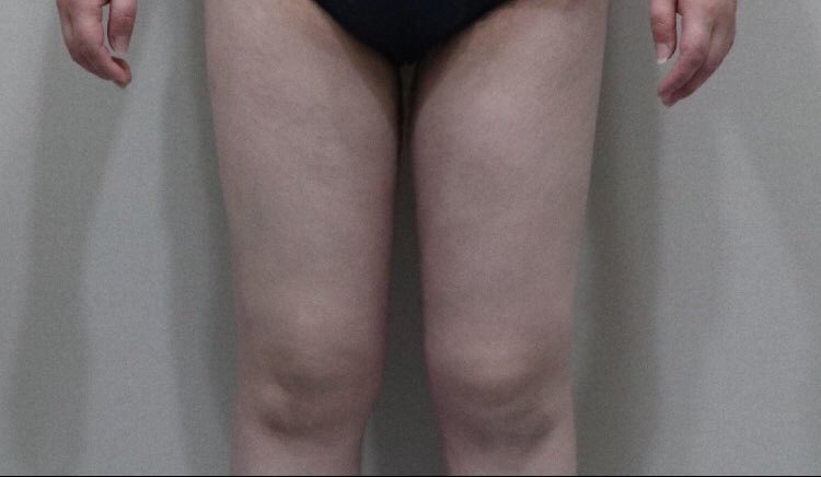 수술후기이미지