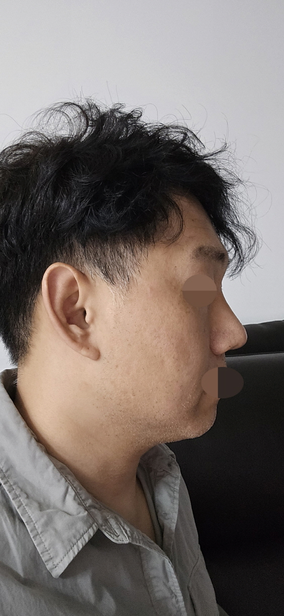 수술후기이미지