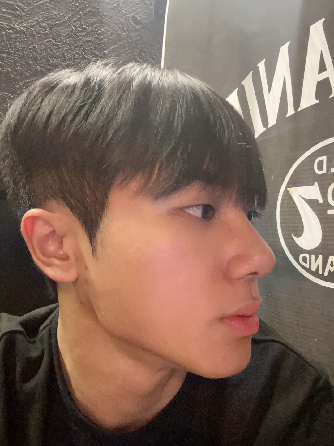 수술후기이미지