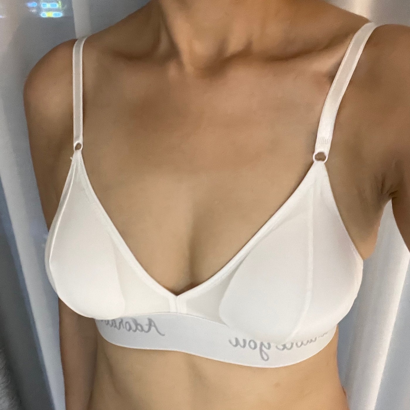 수술후기이미지