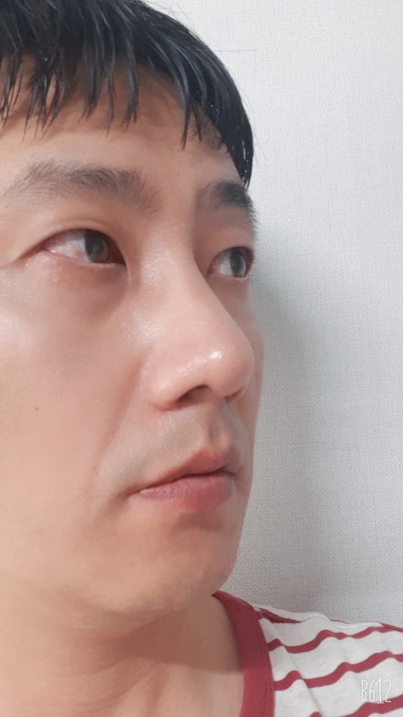 수술후기이미지