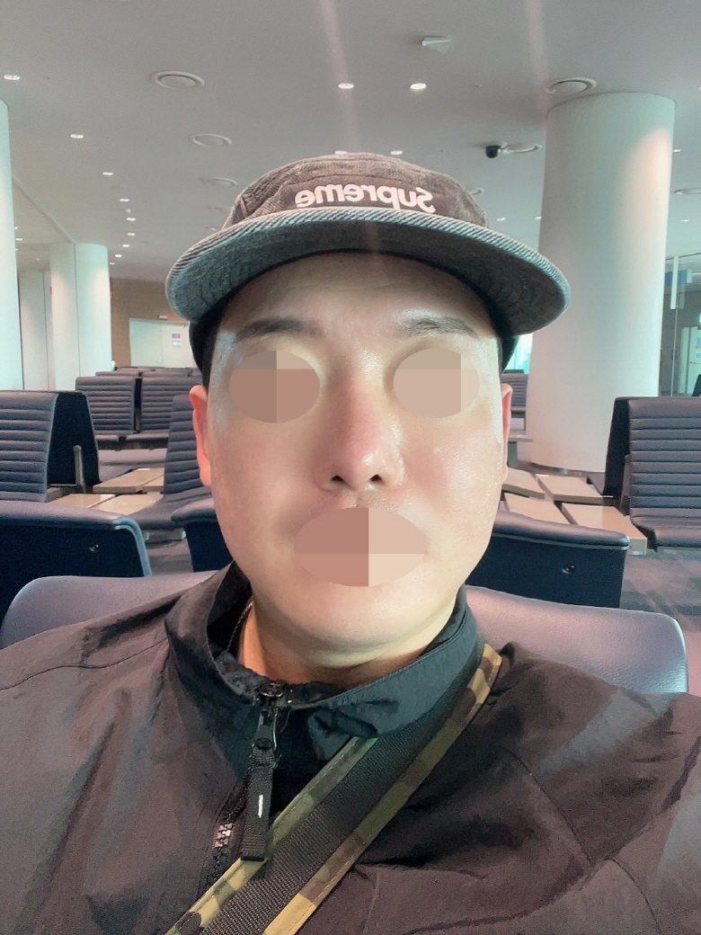 수술후기이미지