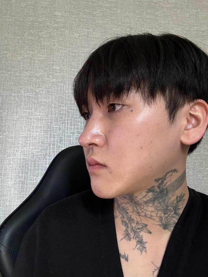 수술후기이미지