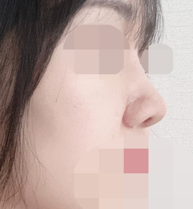 수술후기이미지