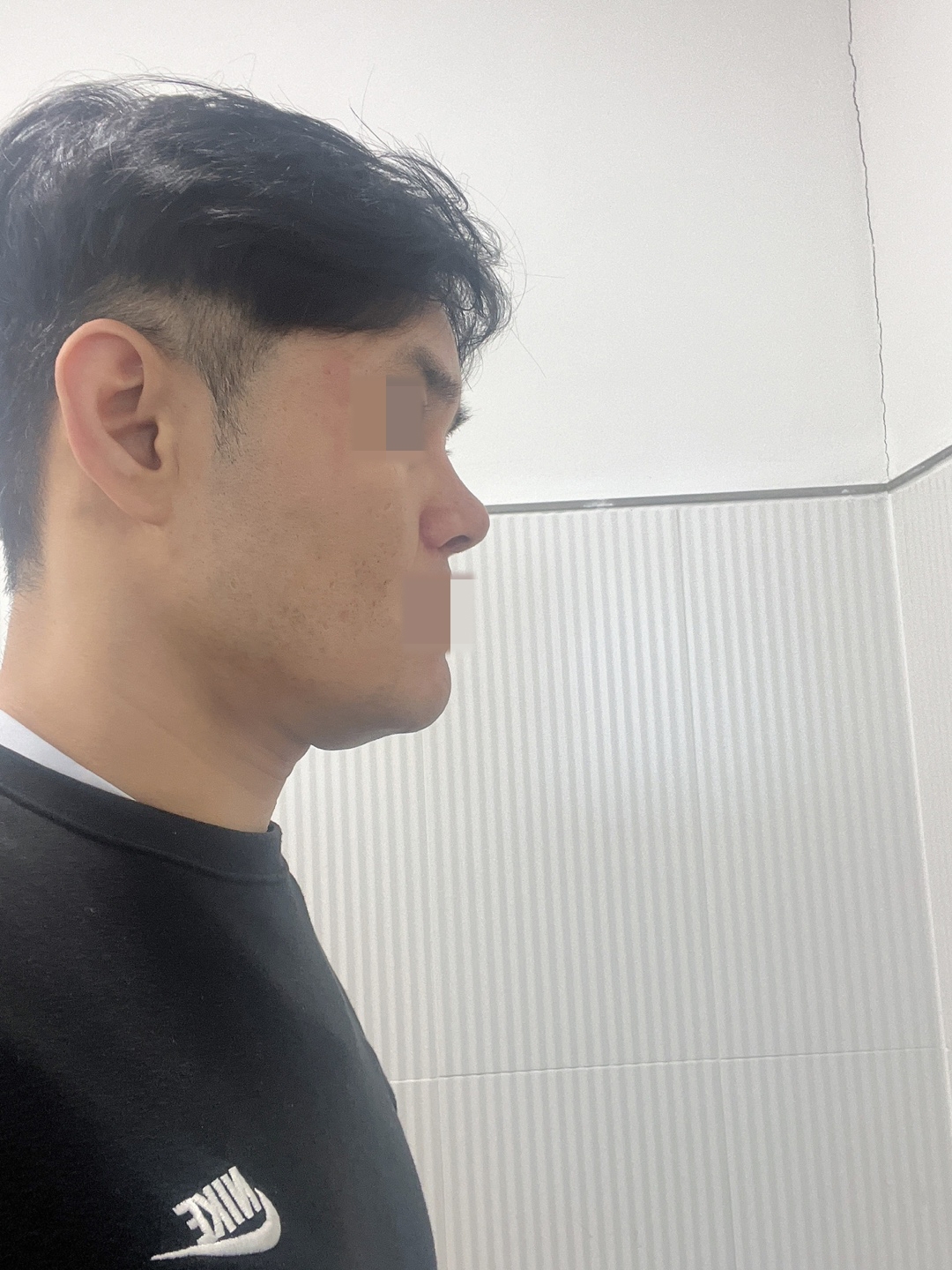 수술후기이미지