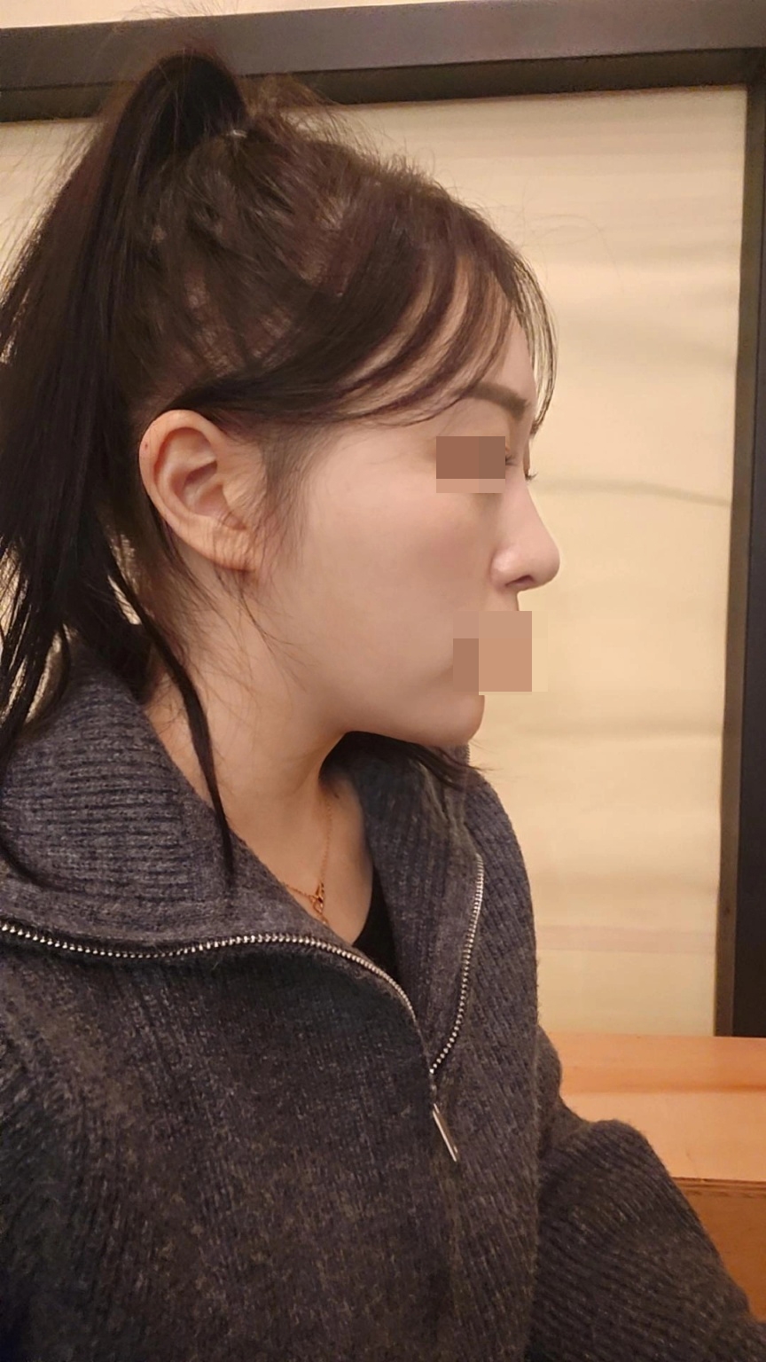 수술후기이미지