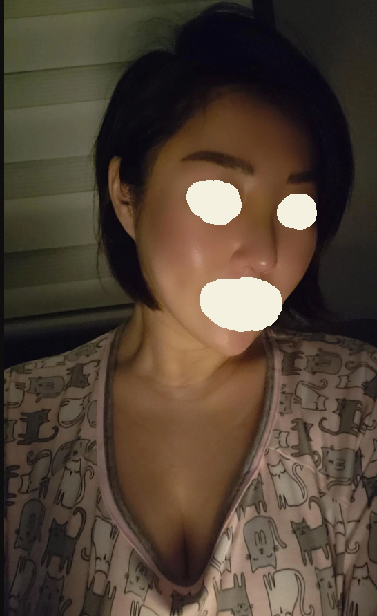 수술후기이미지