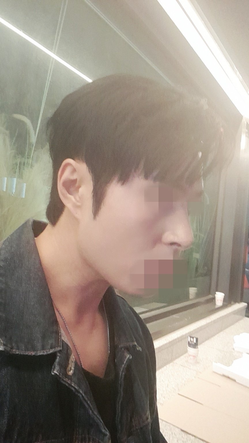 수술후기이미지