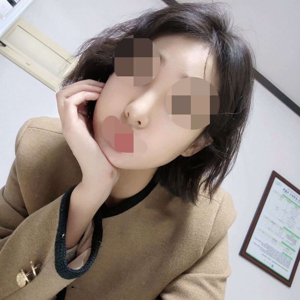 수술후기이미지