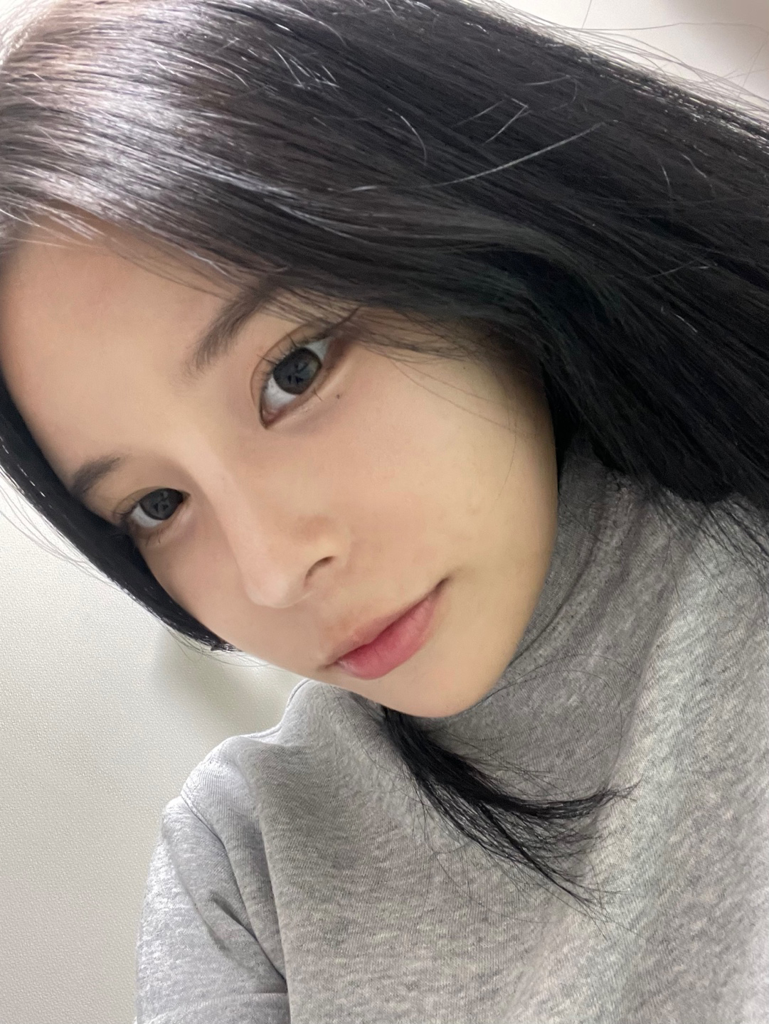 수술후기이미지