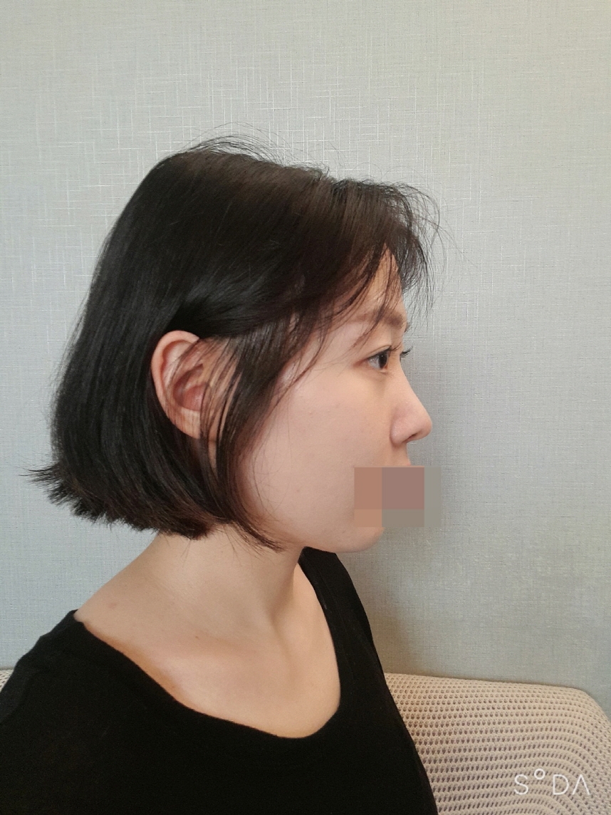 수술후기이미지