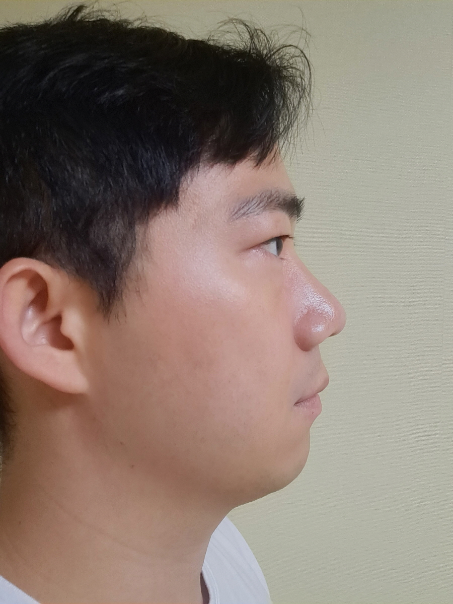 수술후기이미지