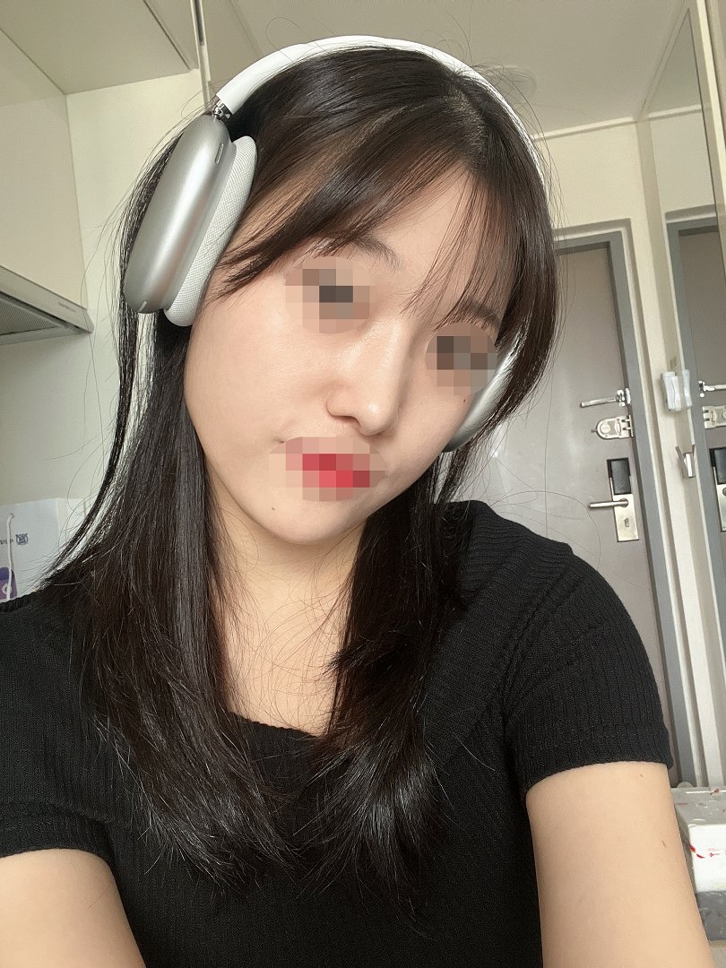 수술후기이미지