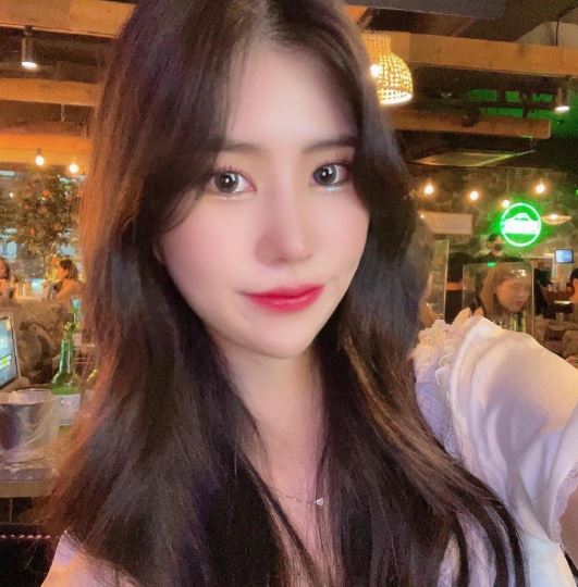 3개월차 수술 후기입니다!