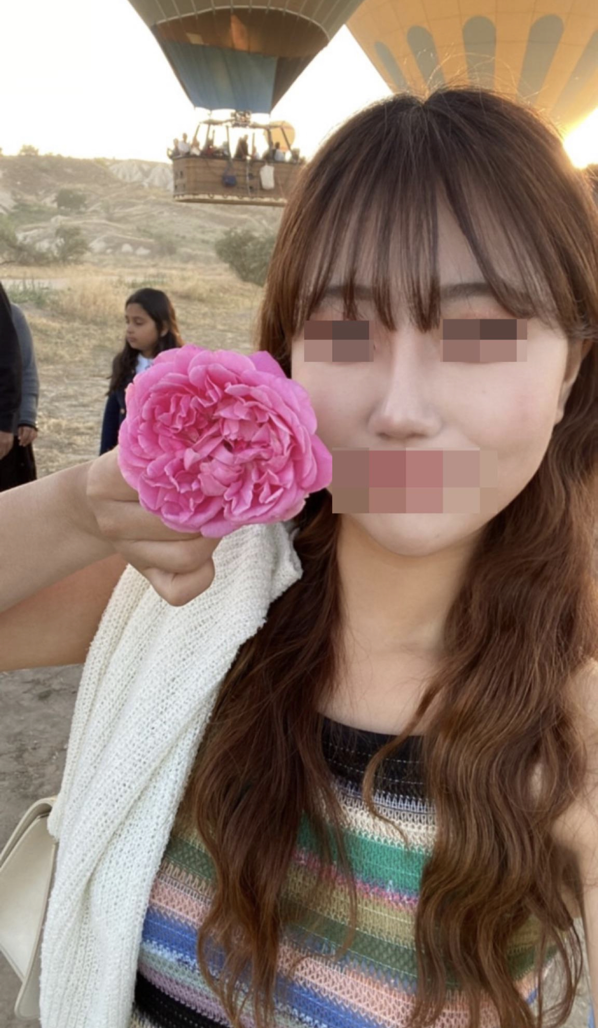 수술후기이미지