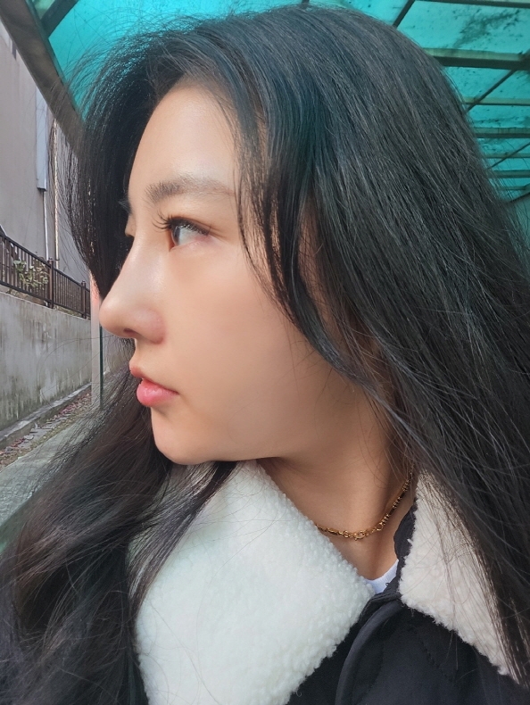 수술후기이미지