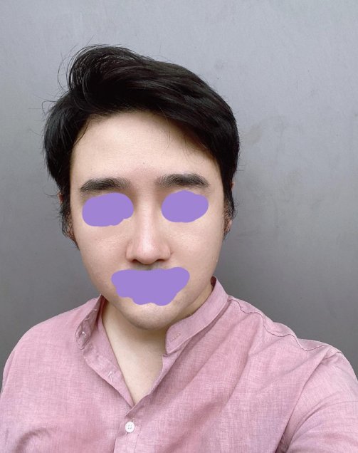 수술후기이미지