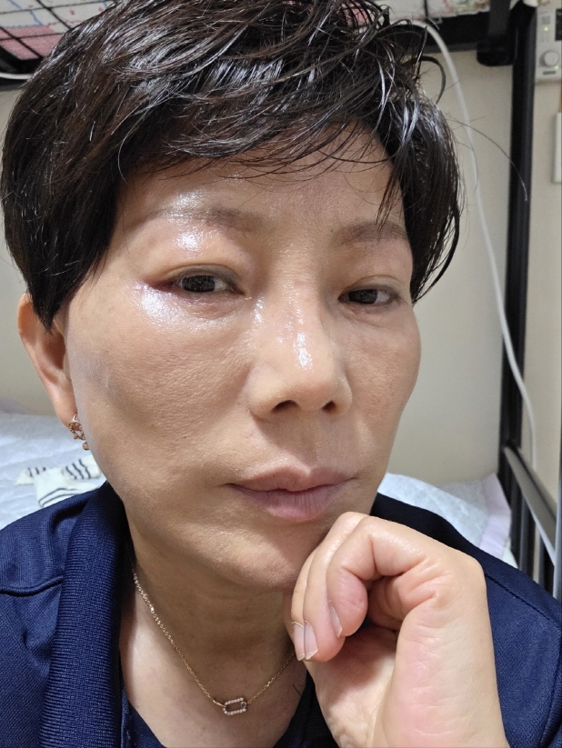 수술후기이미지