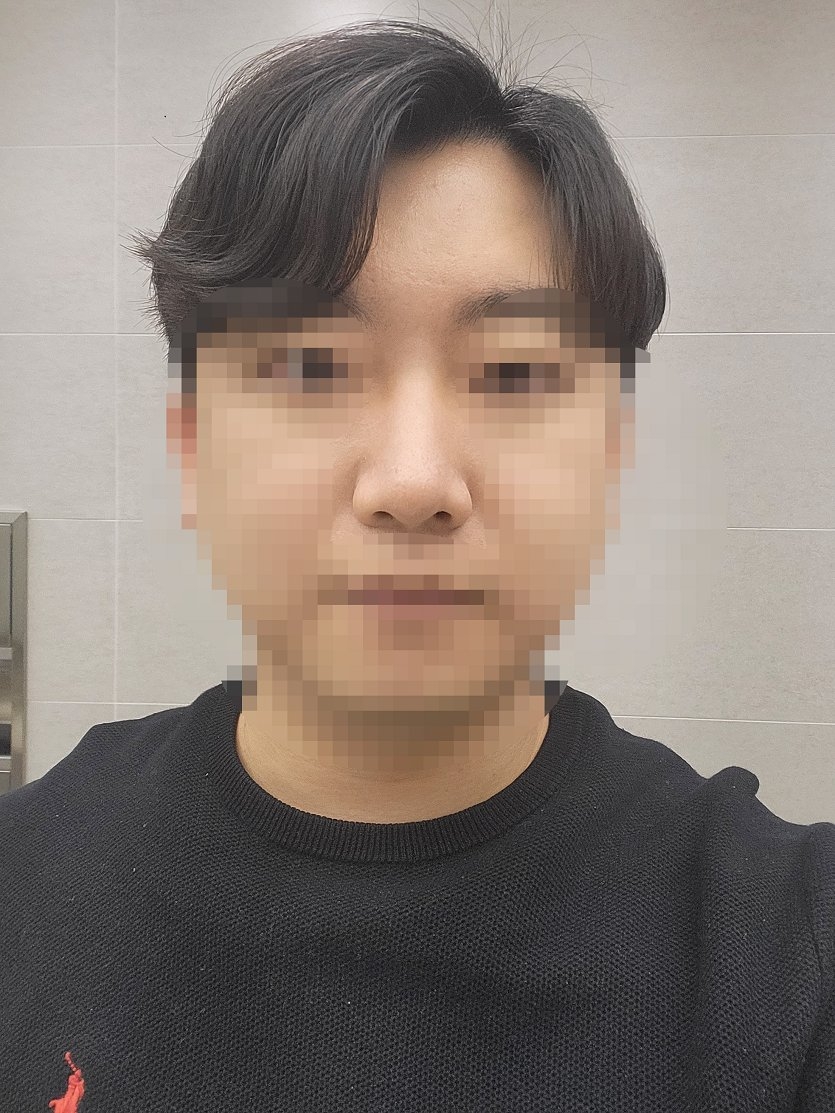 수술후기이미지