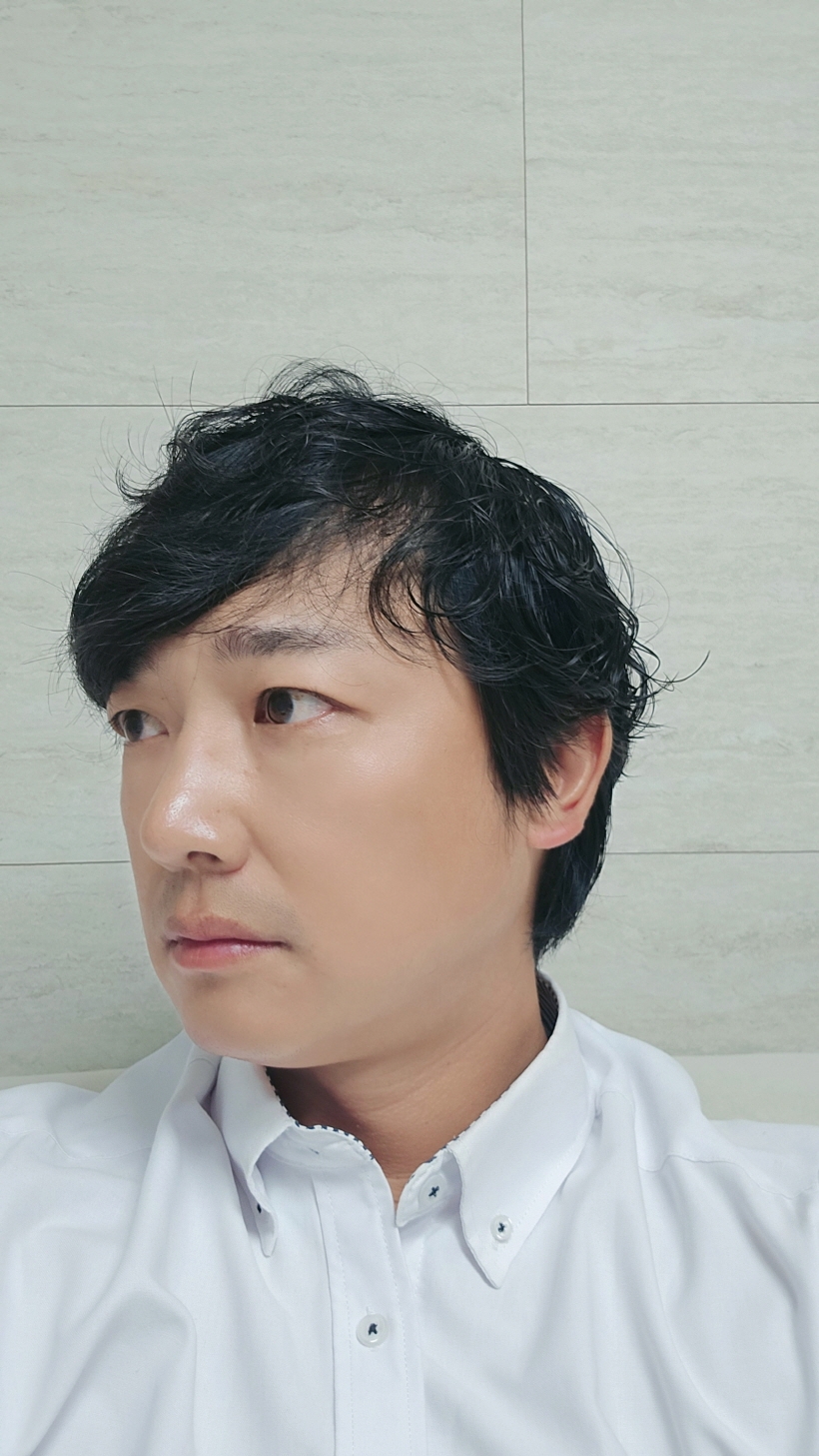 수술후기이미지