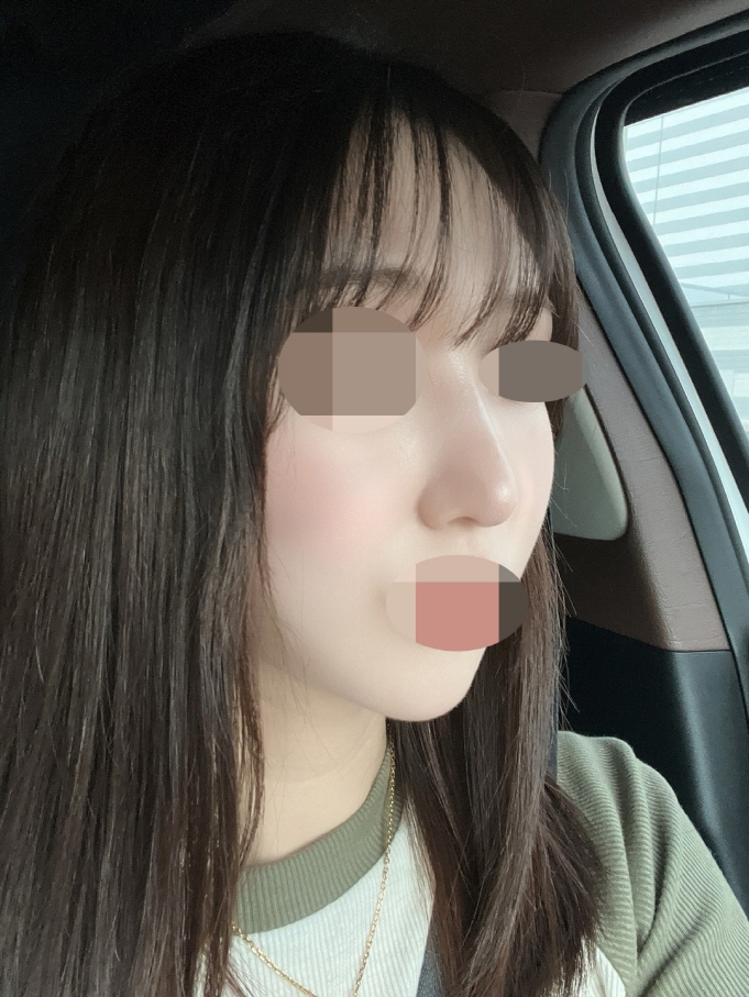 수술후기이미지