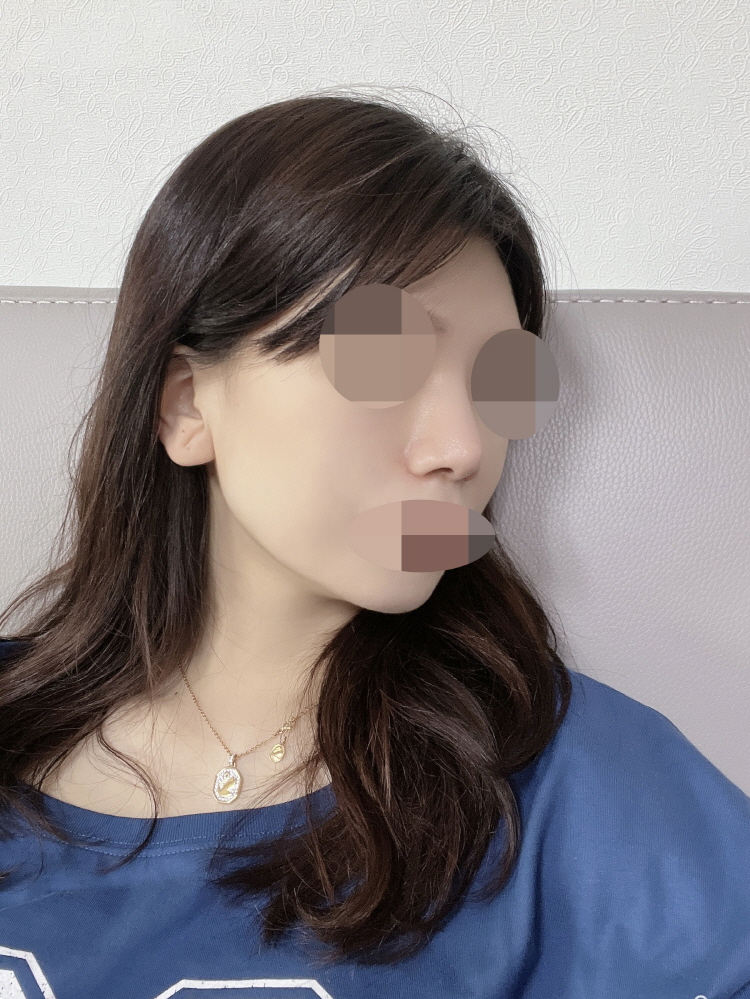 수술후기이미지