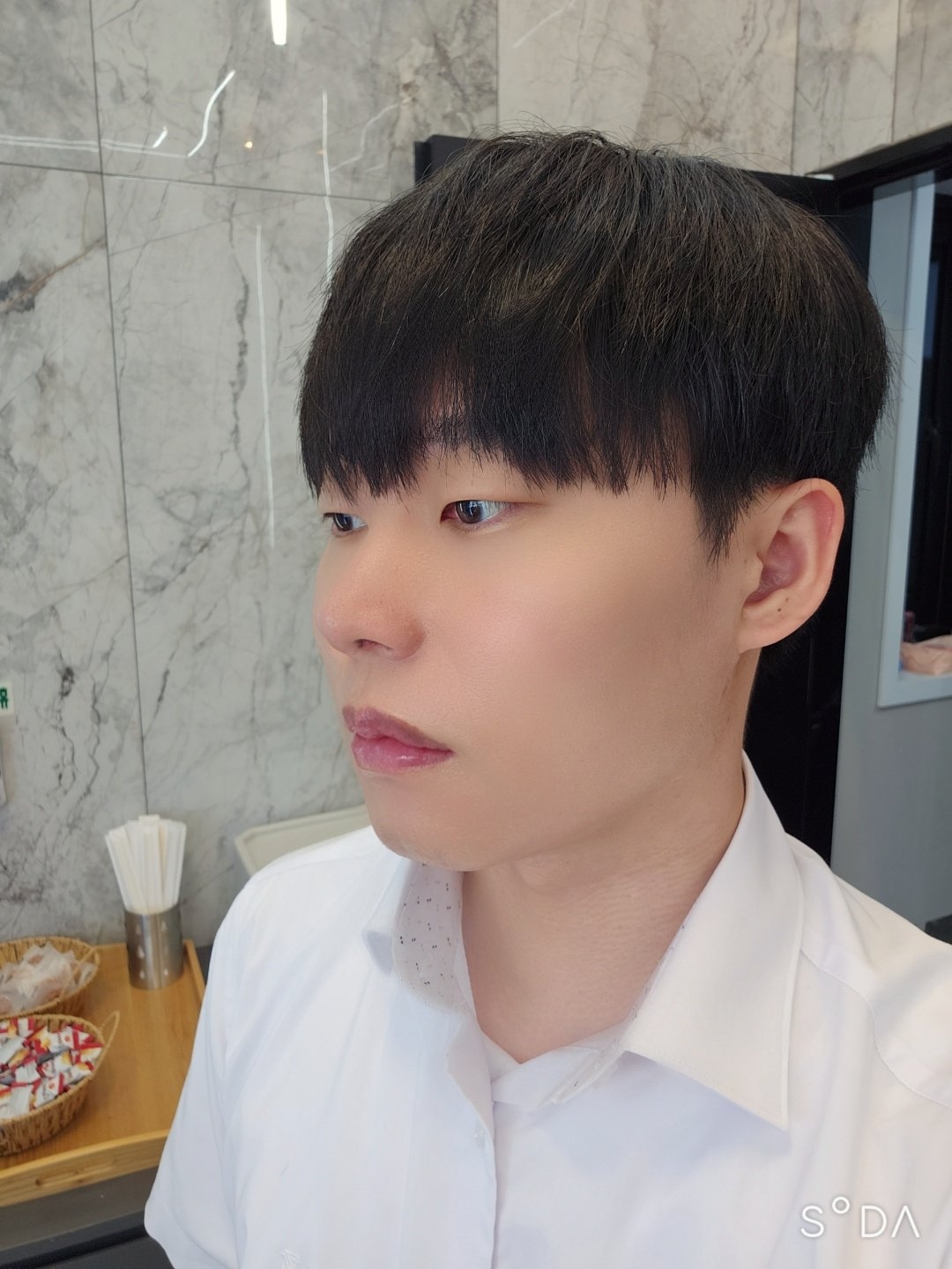 수술후기이미지