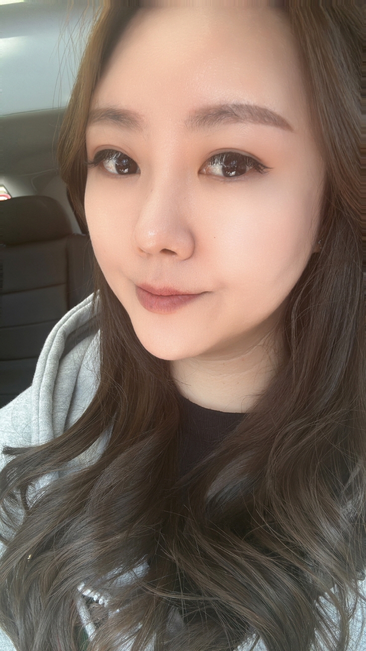 수술후기이미지